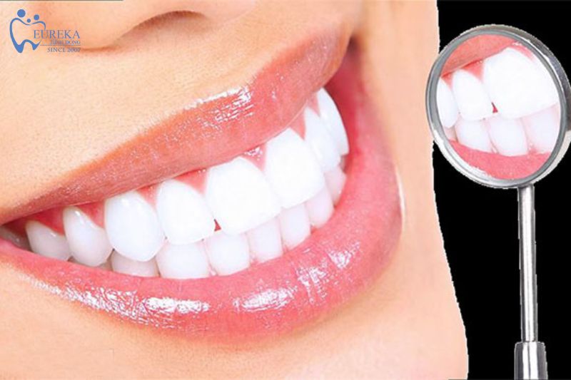 Dịch vụ tẩy trắng răng tại Nha khoa Eureka Bình Đông