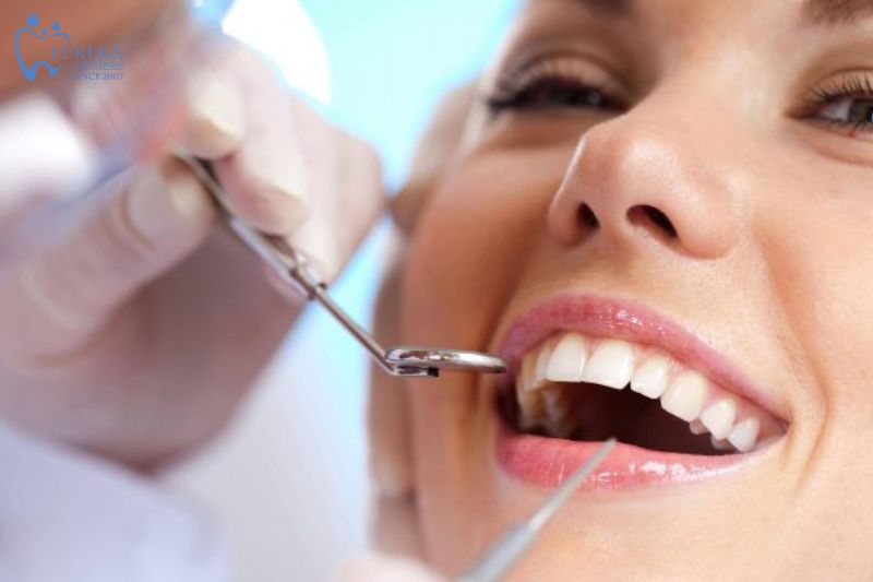 Dịch vụ trám răng tại Nha khoa Eureka Bình Đông