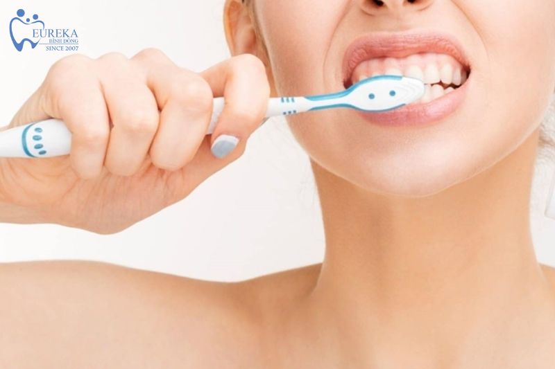 Những lời khuyên khi niềng răng mà bạn cần biết