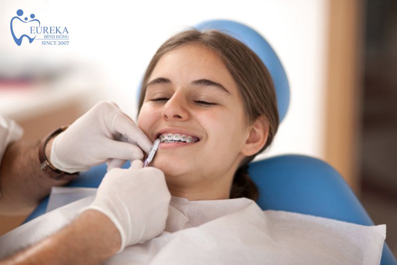 Độ tuổi thích hợp để niềng răng