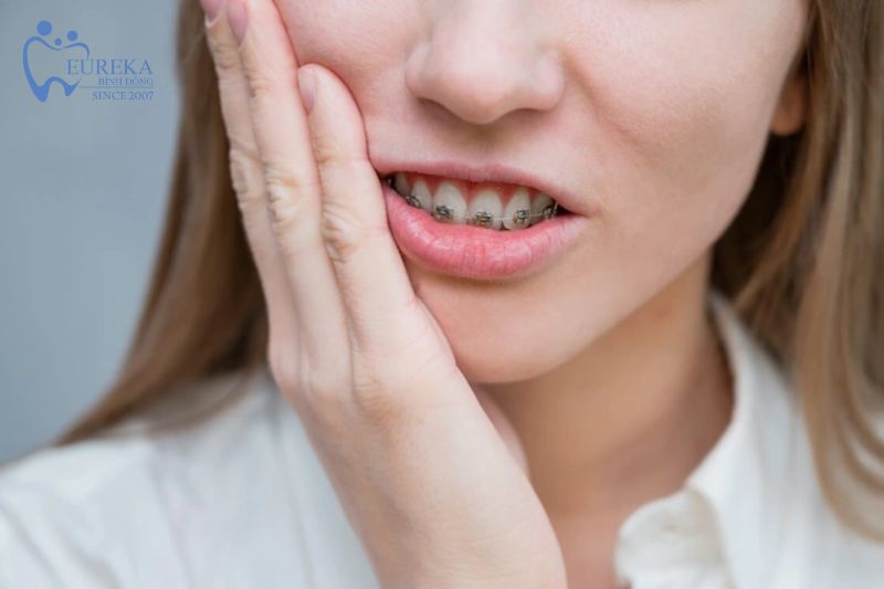 Những vấn đề xảy ra trong quá trình niềng răng