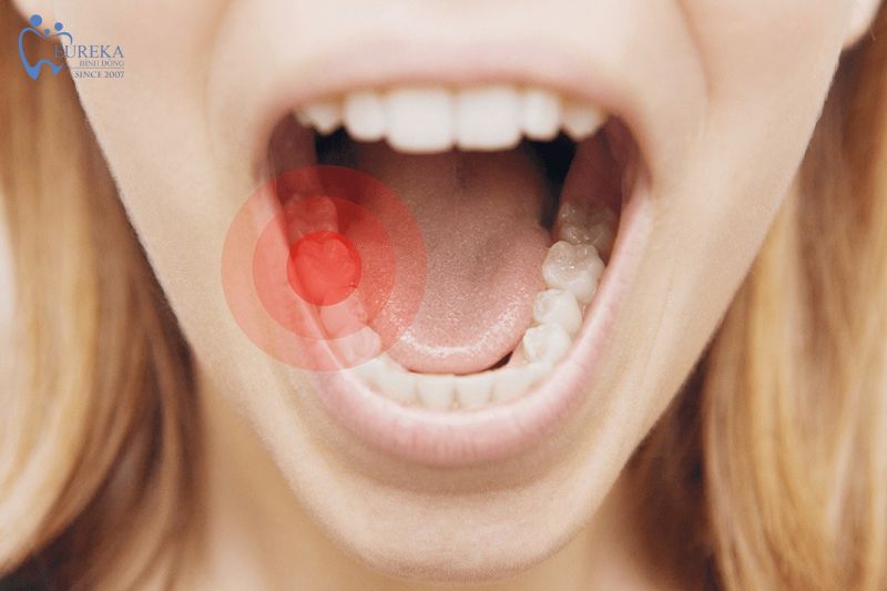 Bị sâu răng đau nhức phải làm sao?