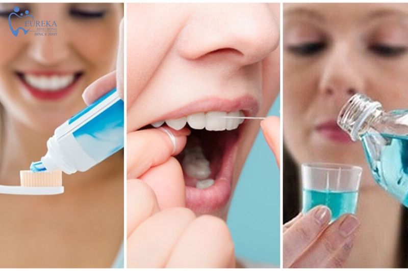 Hướng dẫn cách chăm sóc răng miệng sau bọc sứ