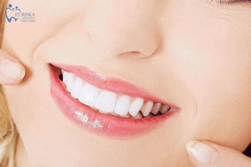 Tẩy trắng răng là gì?