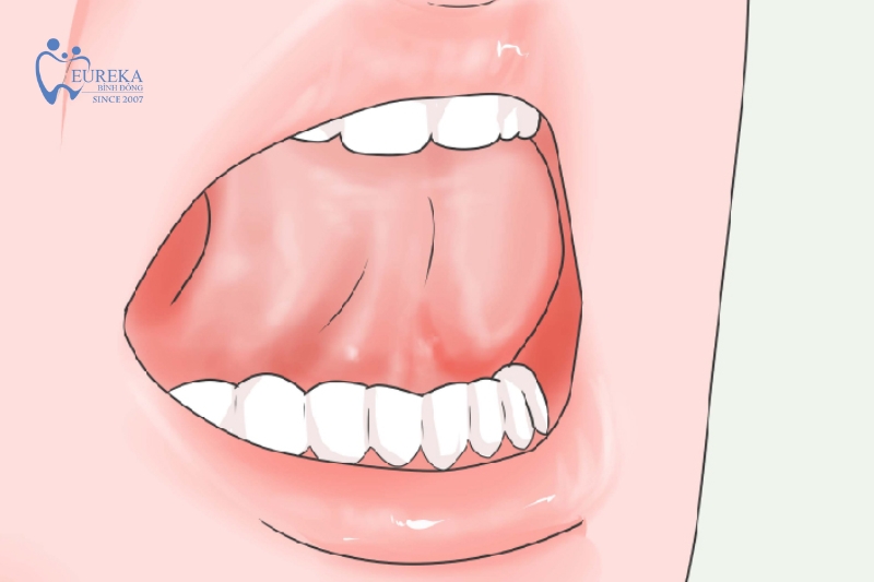 Bài tập lưỡi