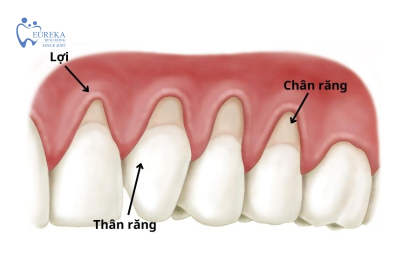 Các phương pháp điều trị tụt nướu răng