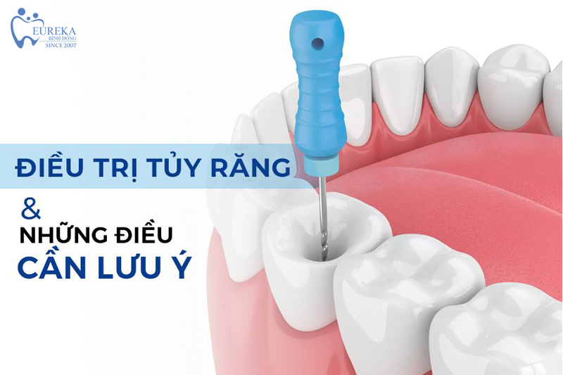 Lợi ích của điều trị răng