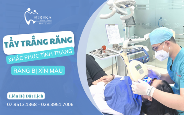 Nguyên nhân răng bị xỉn màu? Phương pháp tẩy trắng răng hiệu quả?