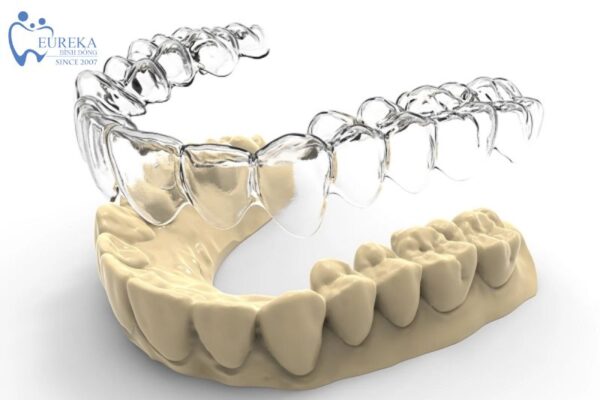 Niềng răng Invisalign nha khoa Eureka