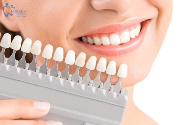 Xu hướng làm răng sứ thẩm mỹ hiện nay