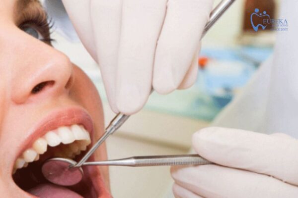 Dịch vụ nha khoa tổng quát tại Nha khoa Eureka Bình Đông