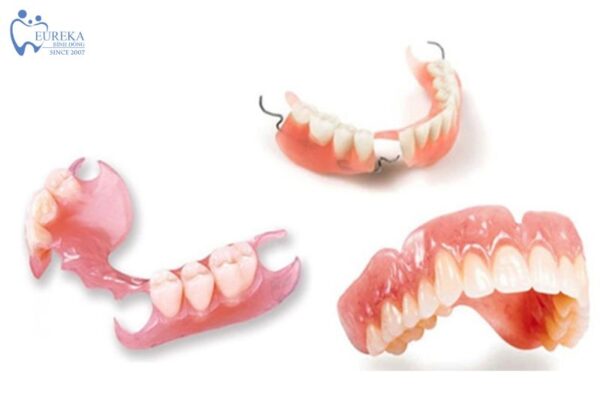 Các bước đặt làm hàm giả tháo lắp