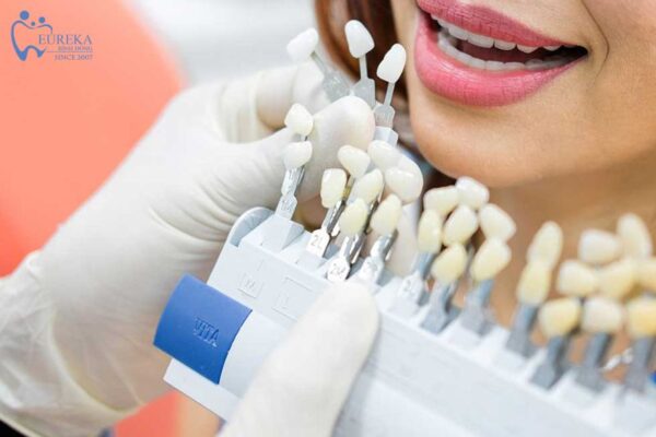 Răng sứ thẩm mỹ liệu có bền không?