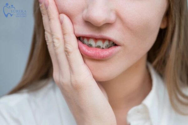 Những tác hại trong quá trình niềng răng