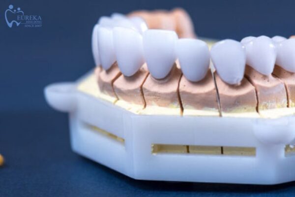 Các bước thực hiện cấy ghép implant