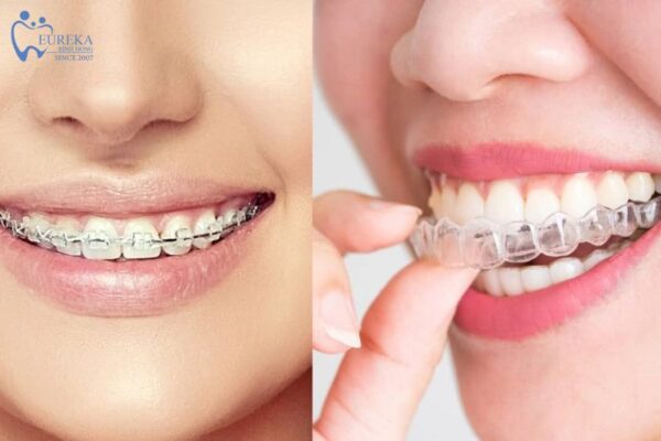 Sự khác biệt về tính thẩm mỹ, chi phí và hiệu quả