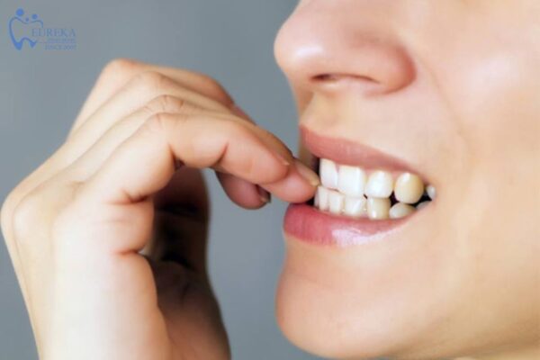 Dùng răng để mở chai, cắn móng tay hoặc nhai bút