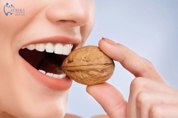 Quá trình bọc răng sứ mất bao lâu?