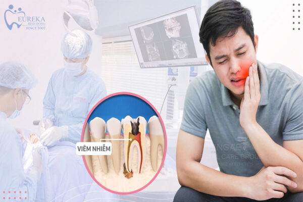 Cách điều trị viêm nhiễm tủy răng