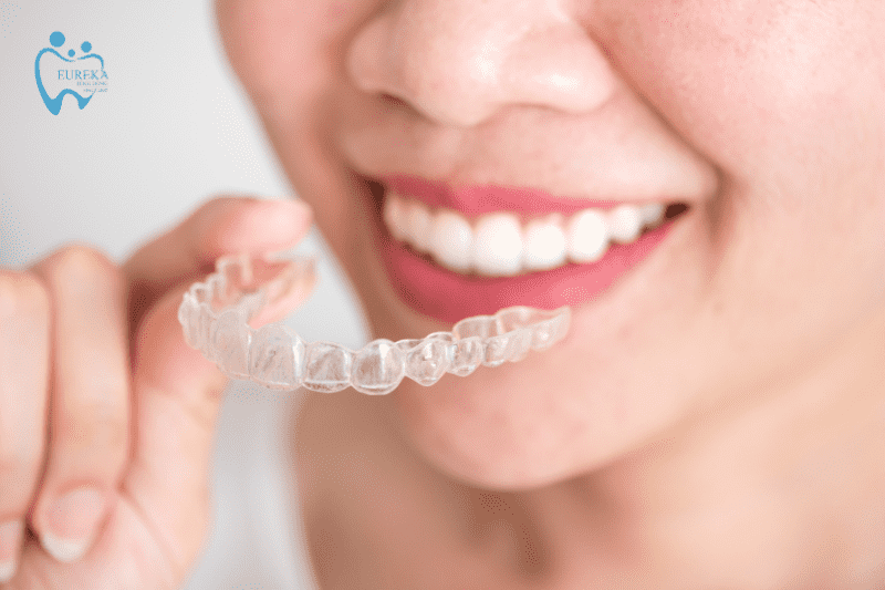 Invisalign dành cho đối tượng nào?