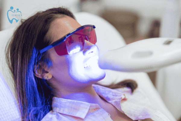 Tẩy trắng răng và những điều bạn nên lưu ý