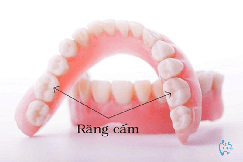 Răng cấm là răng gì?