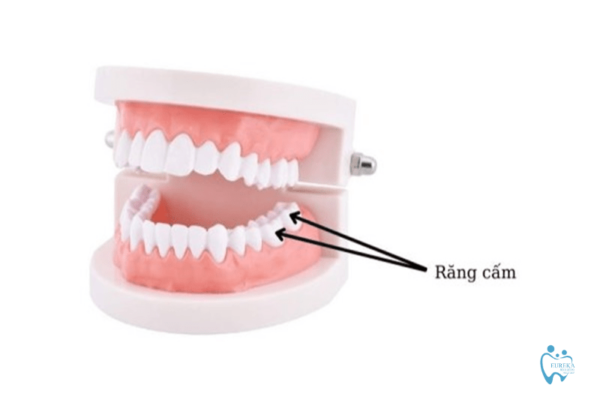 Cách phân biệt răng cấm và răng khôn