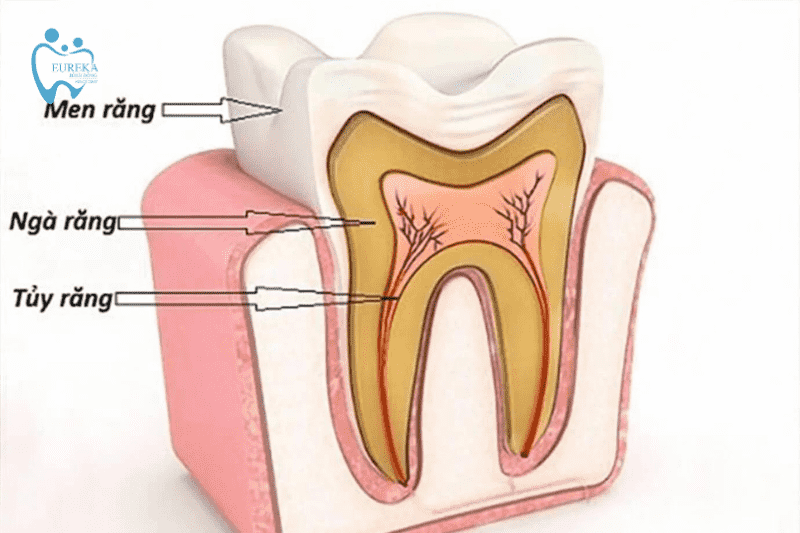 Tủy răng là gì? Một số bệnh lý tủy răng thường mắc phải